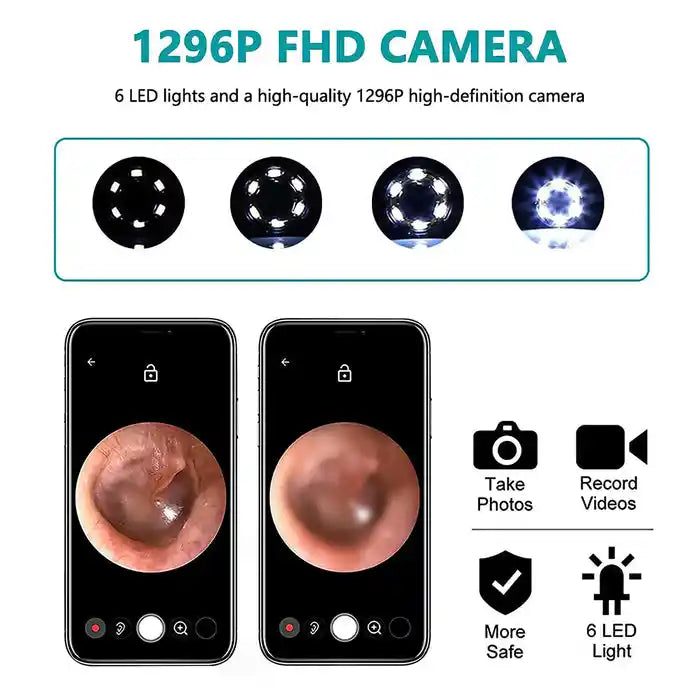 Nettoyeur d'Oreilles Visuel Avec Ecran HD